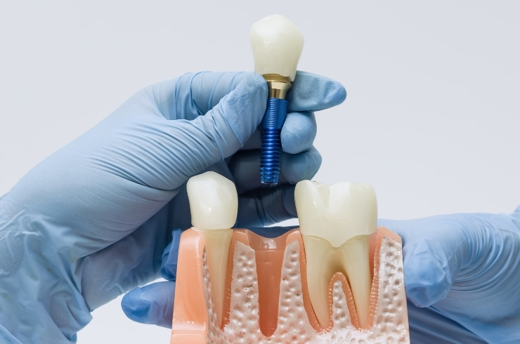 Apex Dental Clinic