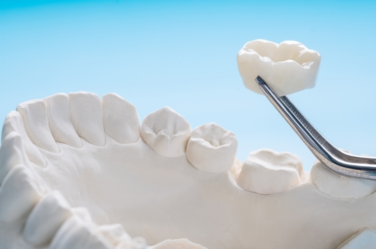 Apex Dental Clinic