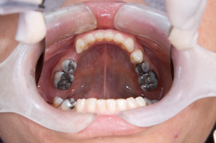 Apex Dental Clinic
