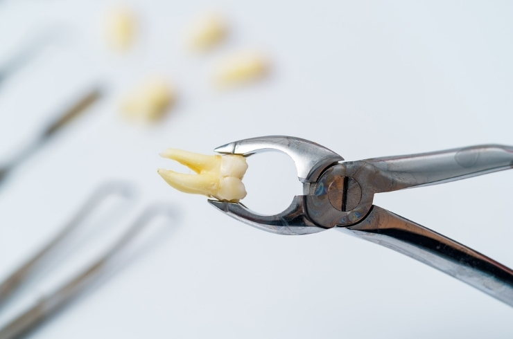 Apex Dental Clinic