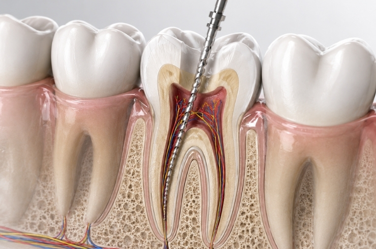 Apex Dental Clinic